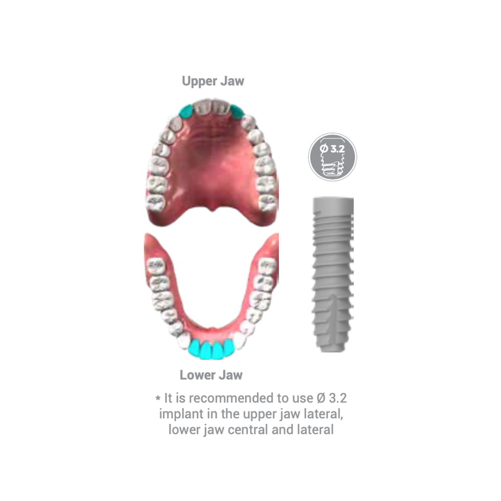 Bone Level Implant Junior 3.2 x 16 mm BioInfinity - BR3216