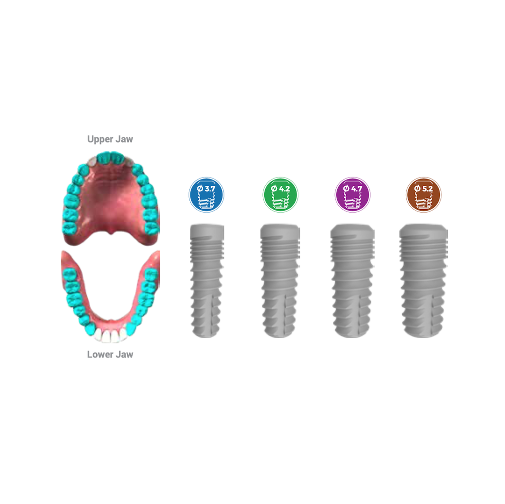 Bone Level Implant Standard 3.7 x 12 mm BioInfinity - BR3712