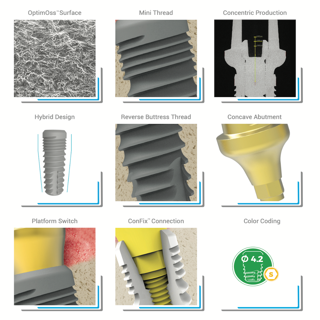 AVPMedTech-dental-surgery-BioInfinity-dental-implant-strength-1024px