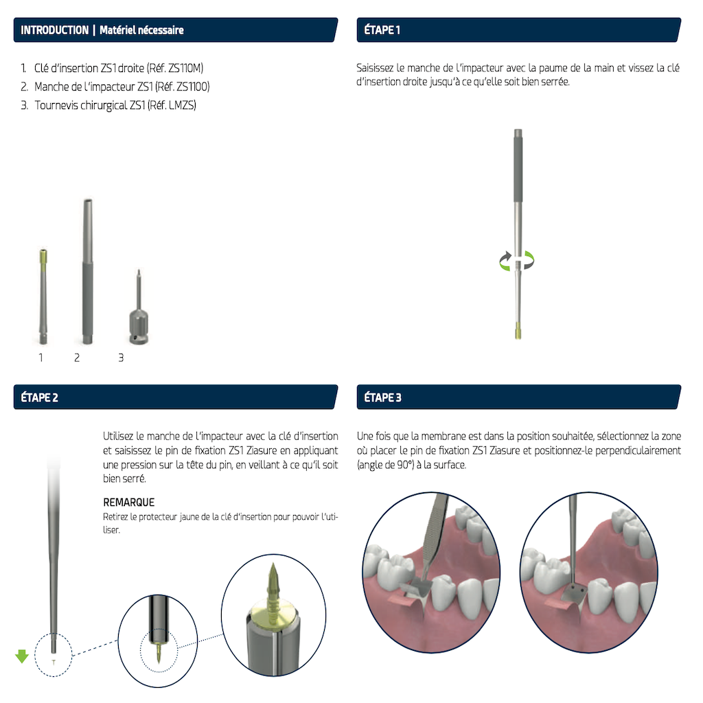 AVPMedTech-instruments-pins-de-fixation-protocol-1